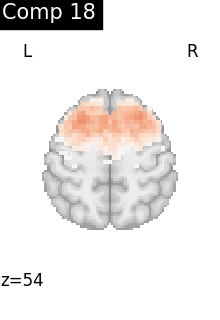 plot compare decomposition