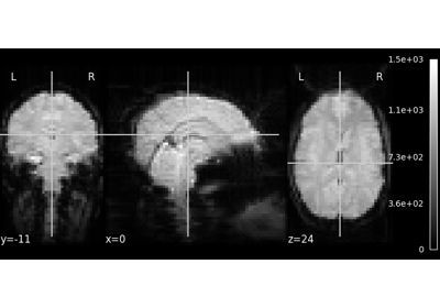 A introduction tutorial to fMRI decoding