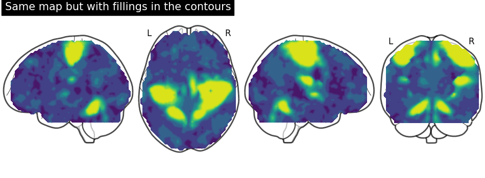 plot demo glass brain extensive