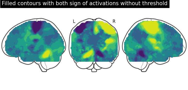 plot demo glass brain extensive