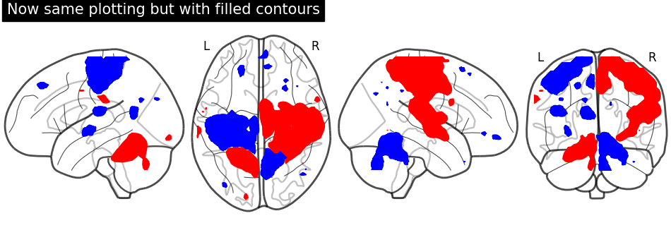 plot demo glass brain extensive