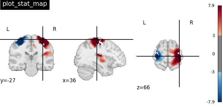 plot_stat_map