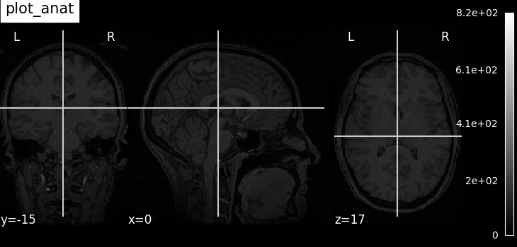 plot_anat