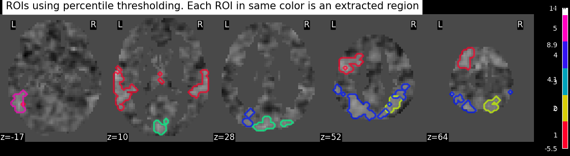plot extract rois statistical maps