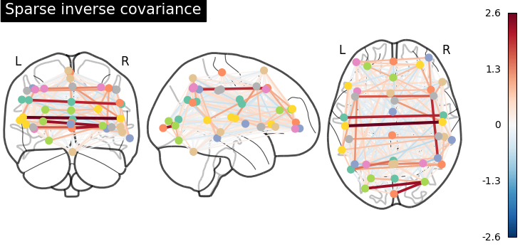 _images/sphx_glr_plot_inverse_covariance_connectome_004.png