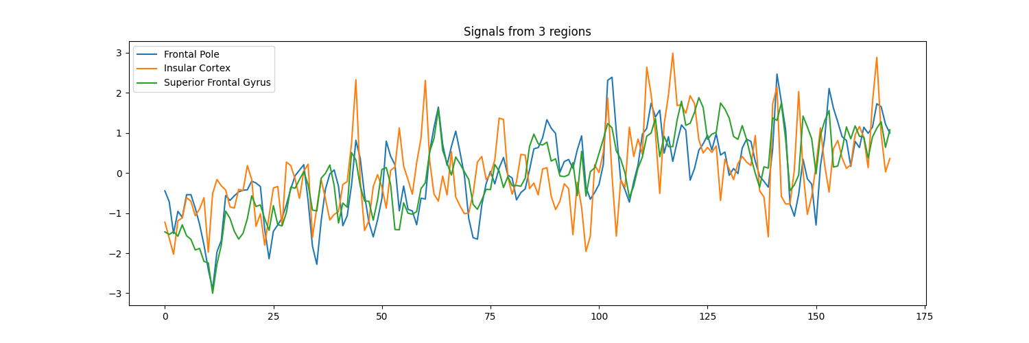 Signals from 3 regions