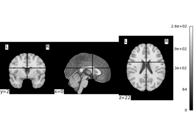 Basic nilearn example: manipulating and looking at data
