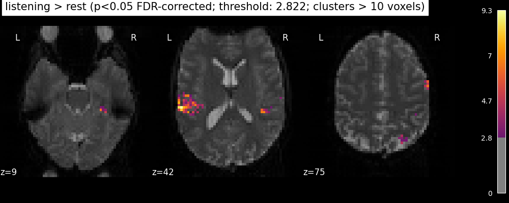 plot single subject single run
