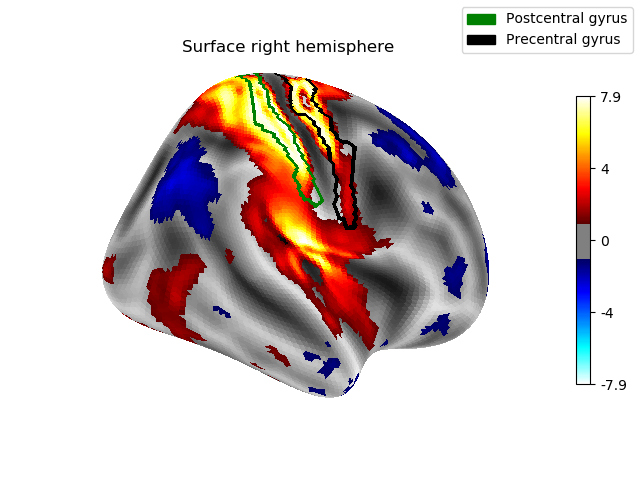 Surface right hemisphere