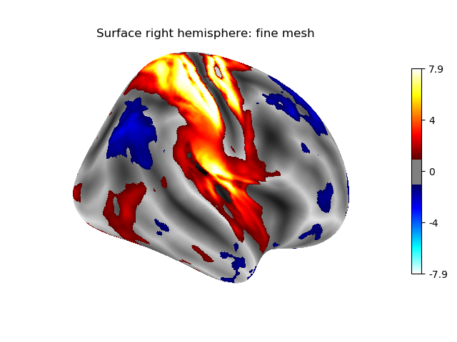 Surface right hemisphere: fine mesh