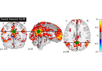 Default Mode Network extraction of AHDH dataset