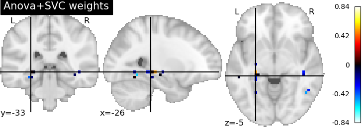 plot advanced decoding scikit