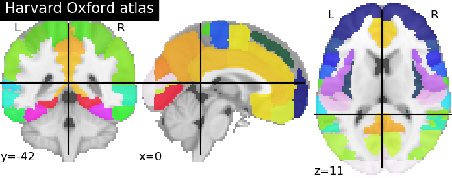 ../_images/sphx_glr_plot_atlas_0011.png