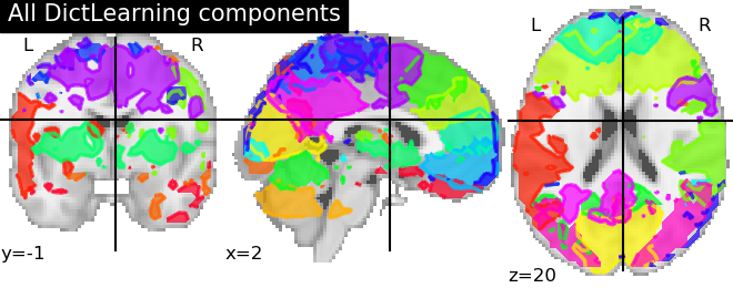 plot compare decomposition