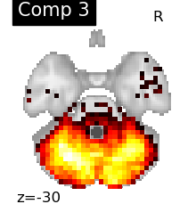 plot compare decomposition