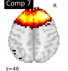 plot compare decomposition