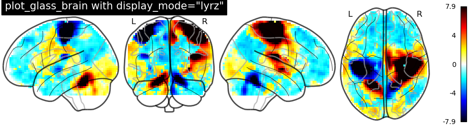 plot demo glass brain extensive