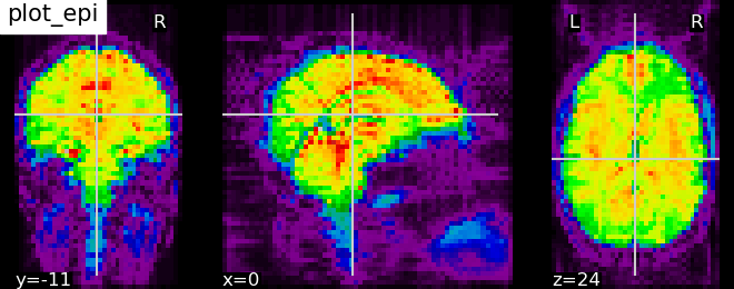 plot_epi