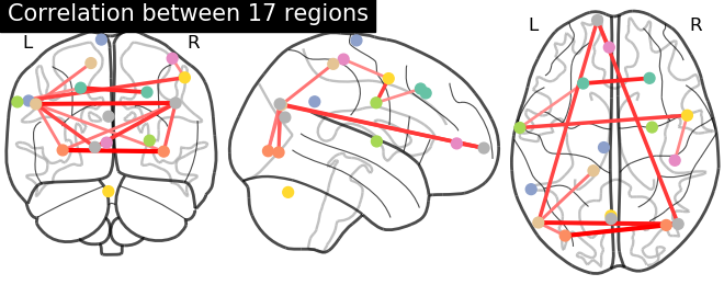 connectome