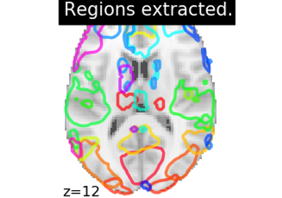 Regions Extraction of Default Mode Networks using Smith Atlas