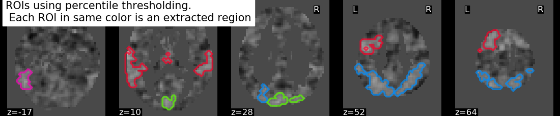 plot extract rois statistical maps