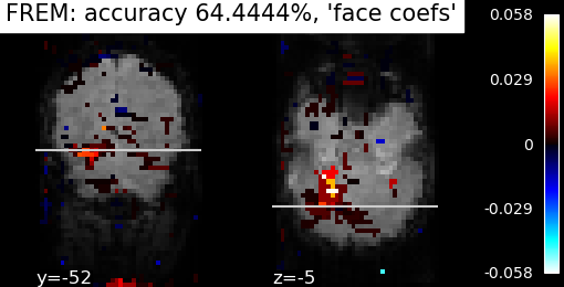 ../_images/sphx_glr_plot_haxby_frem_0011.png