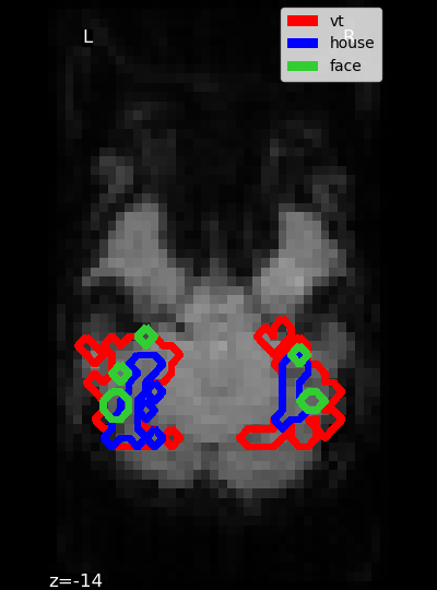 ../_images/sphx_glr_plot_haxby_masks_0011.png