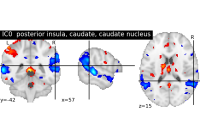 NeuroVault cross-study ICA maps.