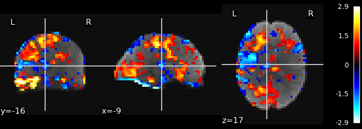 plot ica resting state