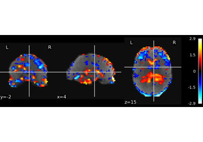 Multivariate decompositions: Independent component analysis of fMRI