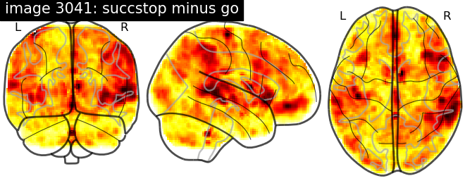 plot neurovault meta analysis