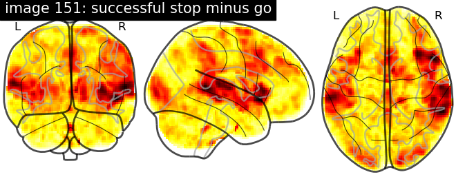 plot neurovault meta analysis