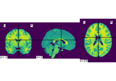 Basic nilearn example: manipulating and looking at data