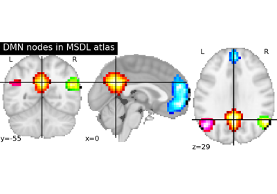 Visualizing a probablistic atlas: the default mode in the MSDL atlas