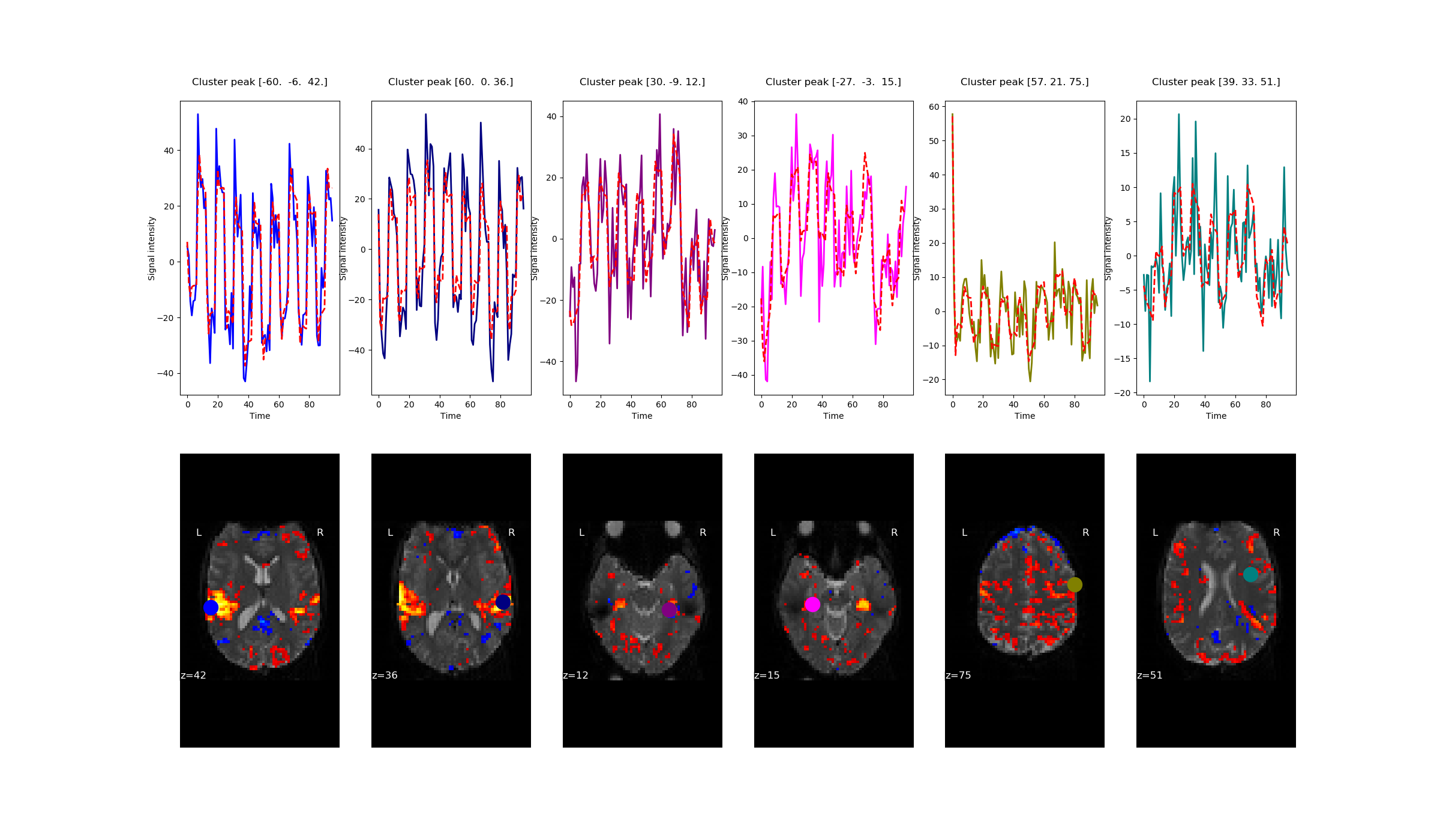 Cluster peak [-60.  -6.  42.] , Cluster peak [60.  0. 36.] , Cluster peak [30. -9. 12.] , Cluster peak [-27.  -3.  15.] , Cluster peak [57. 21. 75.] , Cluster peak [39. 33. 51.]