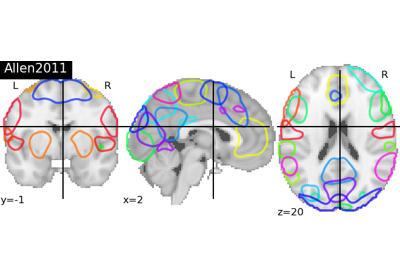 Visualizing 4D probabilistic atlas maps