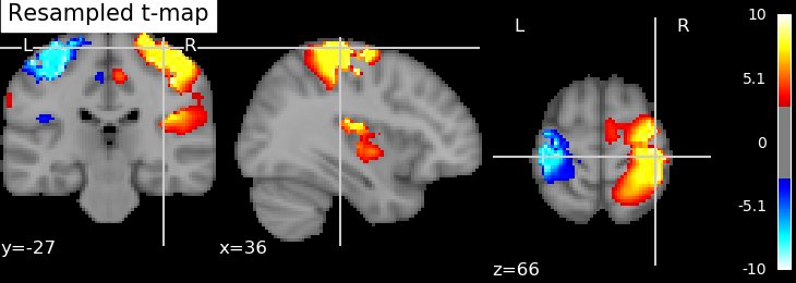 ../_images/sphx_glr_plot_resample_to_template_0021.png