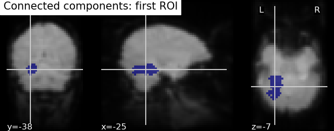 plot roi extraction