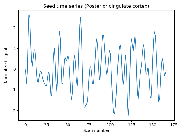 Seed time series (Posterior cingulate cortex)