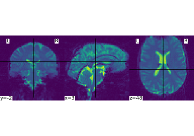 Intro to GLM Analysis: a single-session, single-subject fMRI dataset