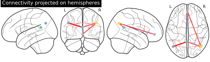 plot sphere based connectome