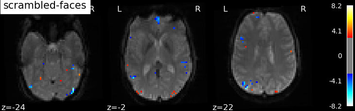 ../_images/sphx_glr_plot_spm_multimodal_faces_0021.png