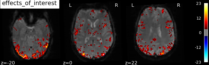 plot spm multimodal faces