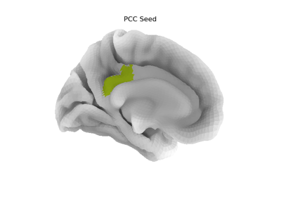 Seed-based connectivity on the surface