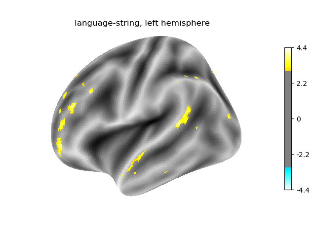 language-string, left hemisphere