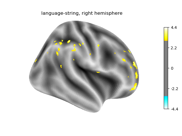 language-string, right hemisphere