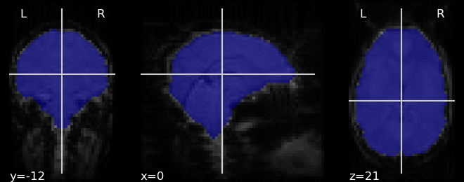 plot visualization