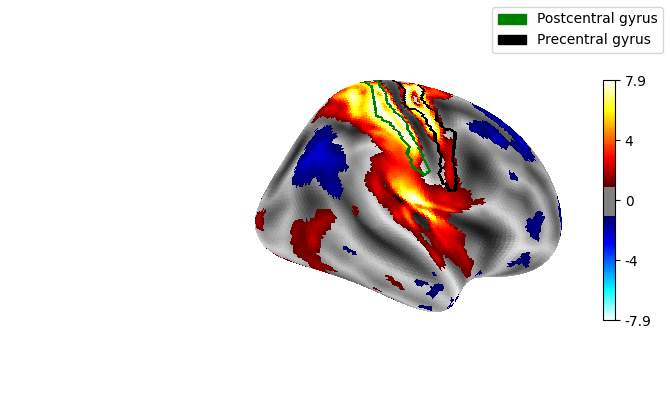 Surface right hemisphere