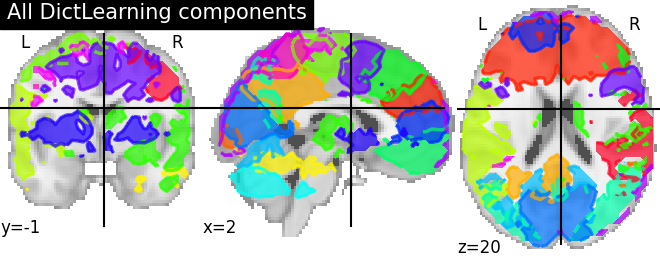 plot compare decomposition