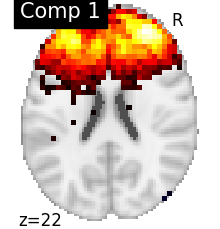 plot compare decomposition